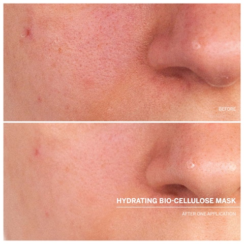 Hydro Bio-Cellulose Mask