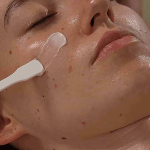 SYSTEM CARE kezelések