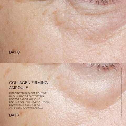 Collagen Firming