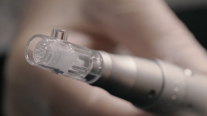 Microneedling Microneedling