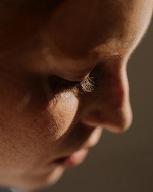 ΠΑΝΑΔΕΣ ΚΑΙ ΚΗΛΙΔΕΣ ΤΟΥ ΔΕΡΜΑΤΟΣ ΠΑΝΑΔΕΣ ΚΑΙ ΚΗΛΙΔΕΣ ΤΟΥ ΔΕΡΜΑΤΟΣ