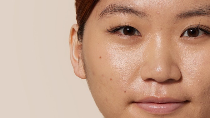 Große Poren verkleinern Große Poren verkleinern